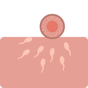 Infertility